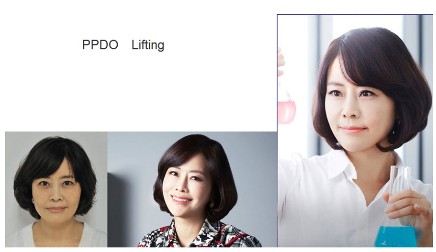 PPDO lifting