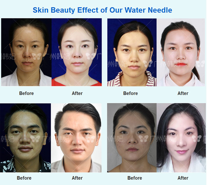 skin care moisturize your skin