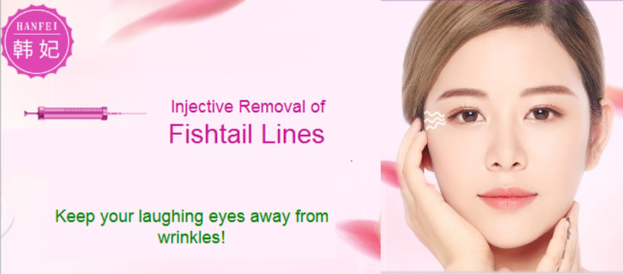 fishtail wrinkle removal