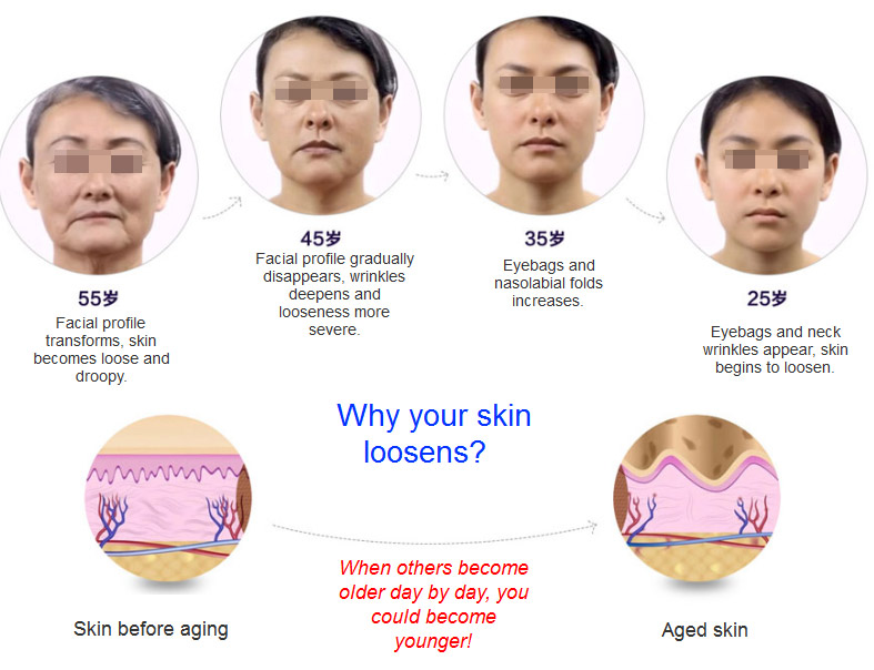 aging skin