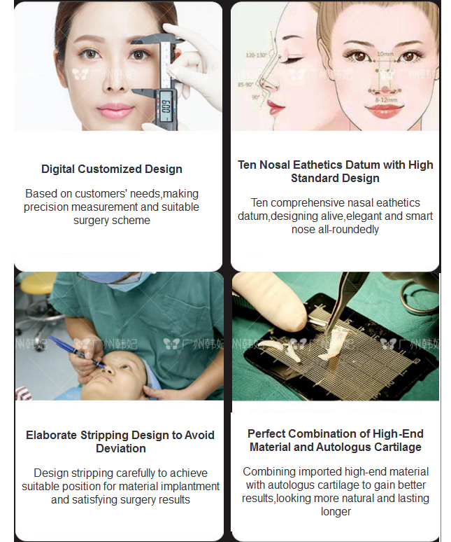 Hanfei Rhinoplasty advantages