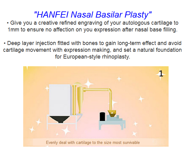 Nasal Basilar Plasty