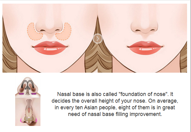 nasal base