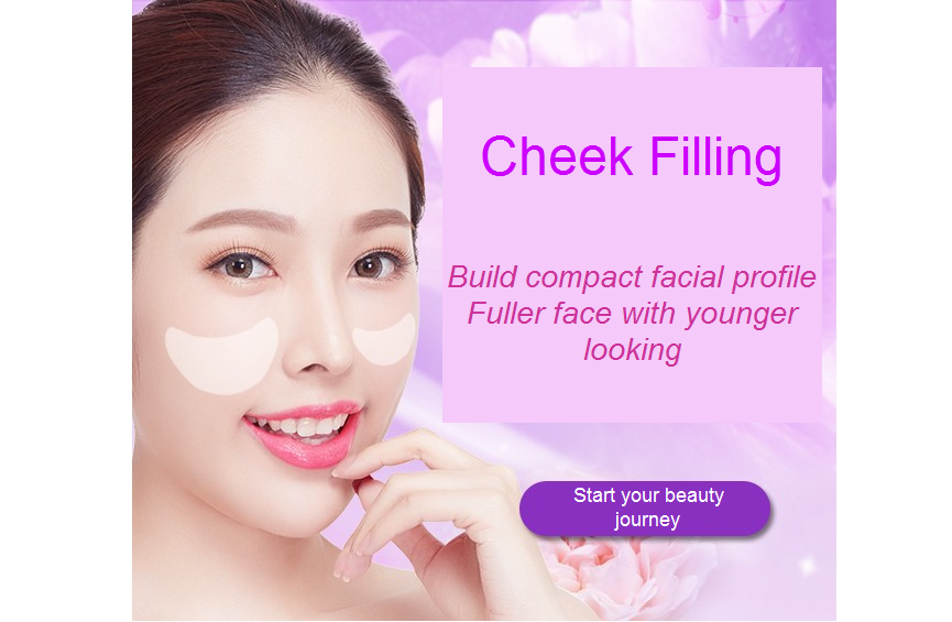 cheek filling