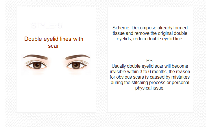 eyelid revision