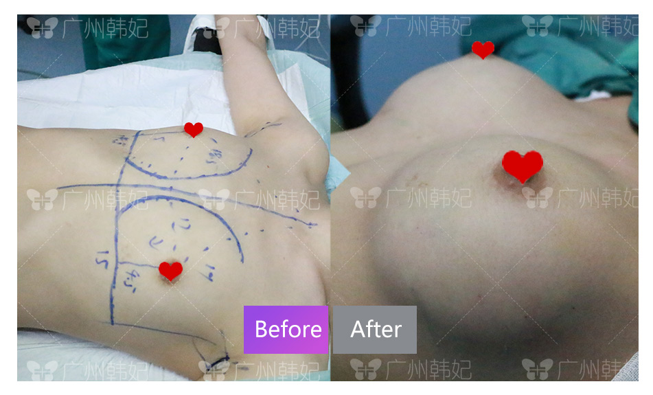 cosmetic surgeries or non-invasive treatments photos