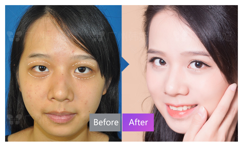 cosmetic surgeries or non-invasive treatments photos