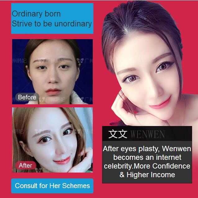 After eyes plasty, Wenwen becomes an internet celebrity.More Confidence & Higher Income