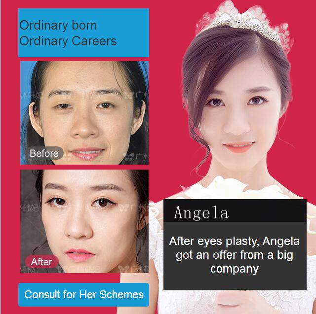 After eyes plasty, Angela got an offer from a big company