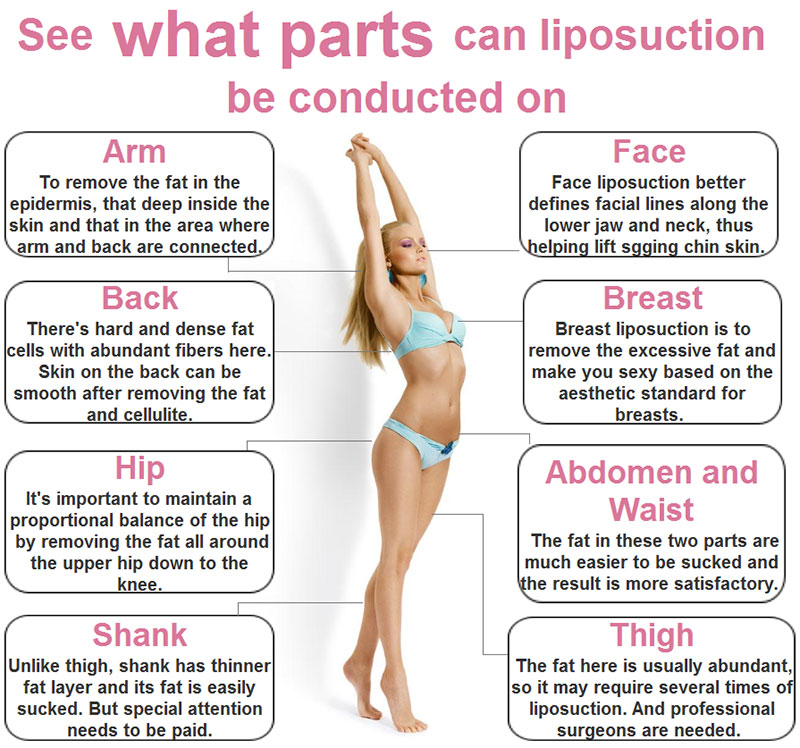 body liposuction cost