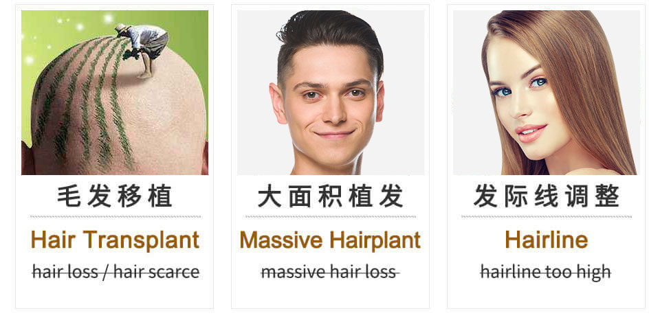 Hanfei Hair Transplant