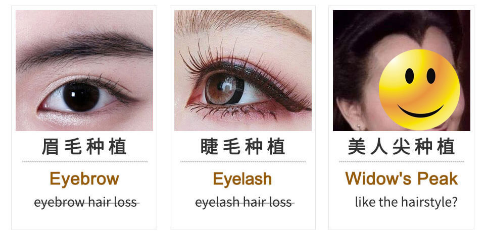 eyelash, eyebrow hair plant