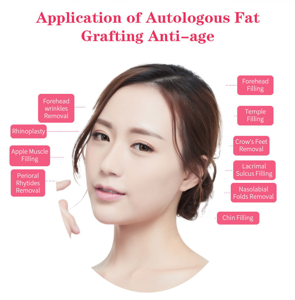 fat grafting anti-aging