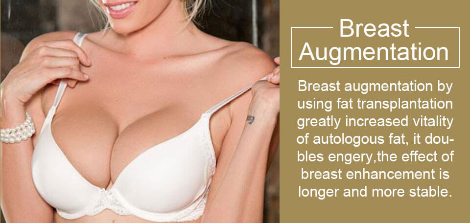 breast augmentation