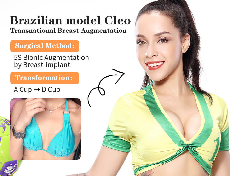 Brazilian model Cleo breast augmentation in Guangzhou China