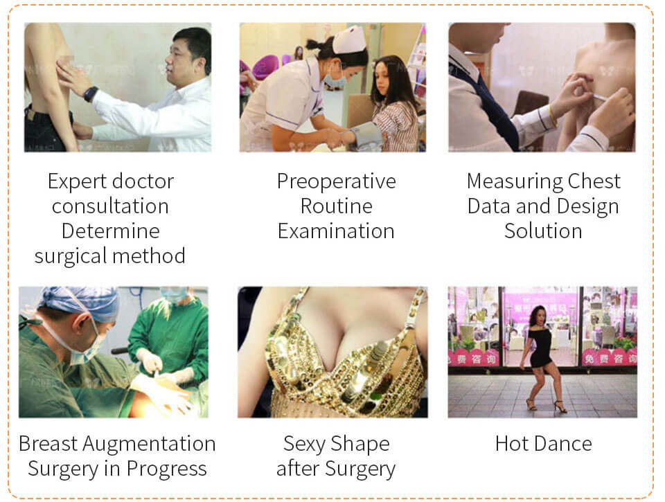 process of breast augmentation procedure